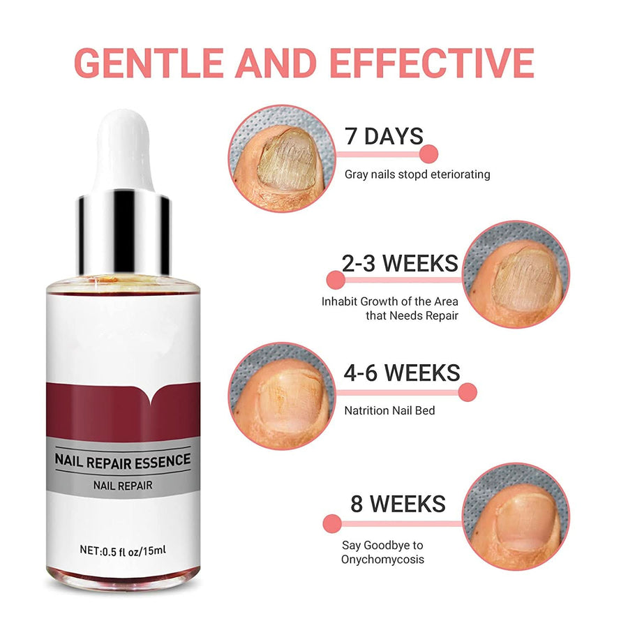 Lanbena Nail Repair Essence, Fingernail & Toenail Repair Nail Treatment 0.5fl.oz - Sccoti