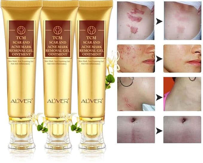 Scar Removal Cream - TCM Scar Cream for Surgical Scars, Acne Skin Care Cream, Acne Treatment Cream for Scars, Burns, Stretch Marks, Acne Spots - Sccoti