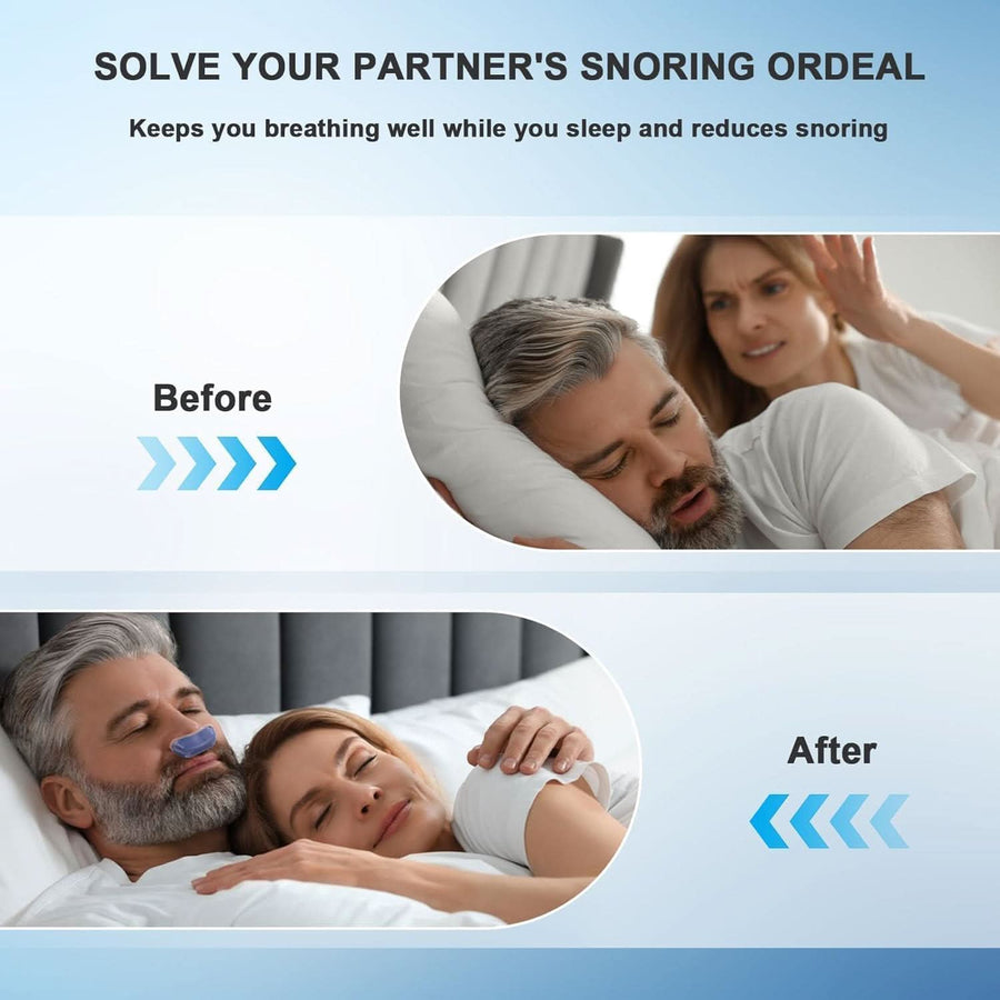 Double Vortex Anti Snoring Device - Effective Snoring Solution - Sccoti