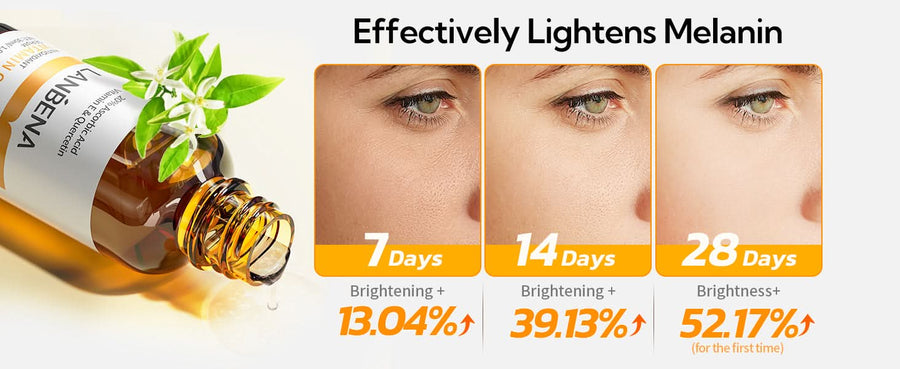 20% Vitamin C Serum For Face, Brightening Skin, Dark Spot Remover, Reduce Wrinkle, Anti Aging Glowing Serum, Facial Moisturizer with Niacinamide, Vitamin E, Hyaluronic Acid, 15 ML/ 0.51 Fl oz - Sccoti