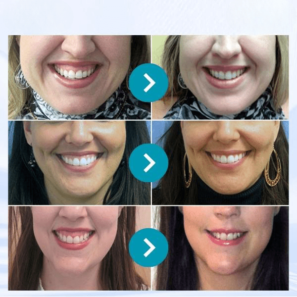 JaySuing™ Therapeutic Gel for Gum Relief - Sccoti